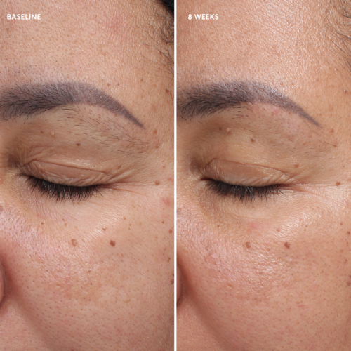 Today’s Deal Total Eye® Firm & Repair Cream - Image 6