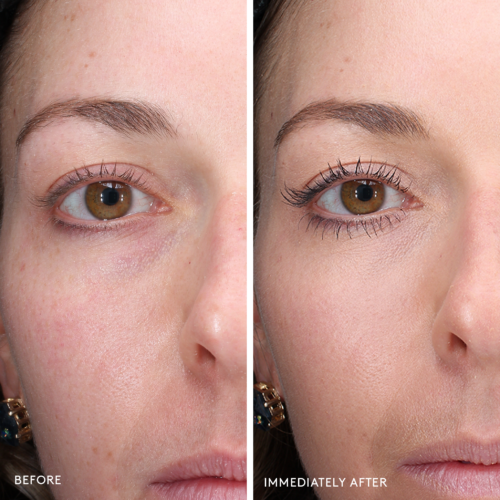 Today’s Deal Total Eye® 3-in-1 Renewal Therapy SPF 35 - Image 12