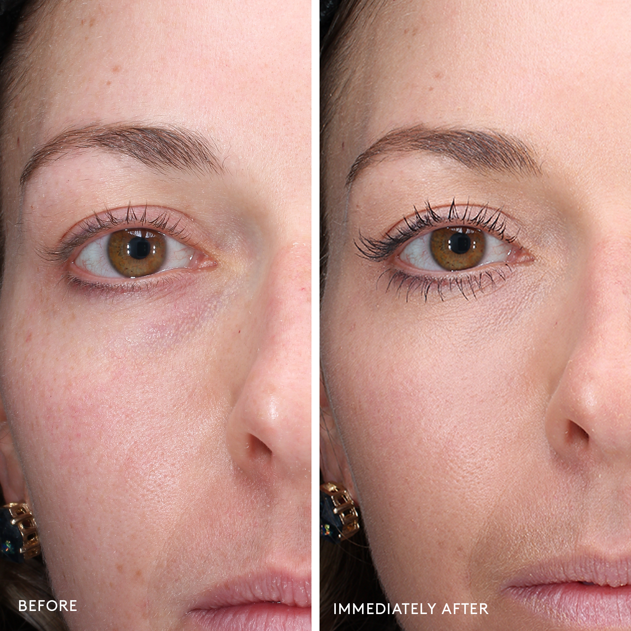 Today’s Deal Total Eye® 3-in-1 Renewal Therapy SPF 35 - Image 12